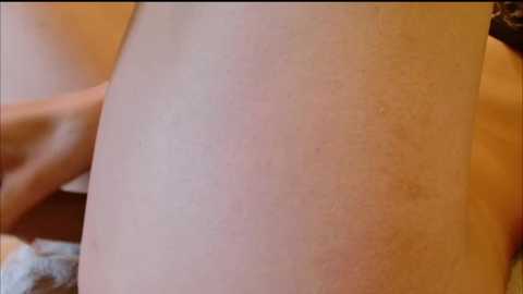 Media: Video of a close-up of a person's thigh with a red, slightly swollen area, possibly from a bug bite or rash, and a hand gently touching the skin. Background is blurred, warm-toned, likely indoor setting.