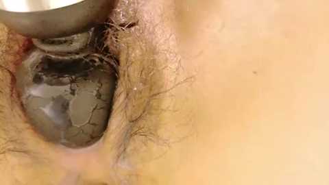 Media: A close-up video of a human ear canal, showing a partially visible earbud lodged in the ear canal, surrounded by light brown, hairy skin. The image highlights the ear's anatomy and the potential issues caused by improper earbud insertion.