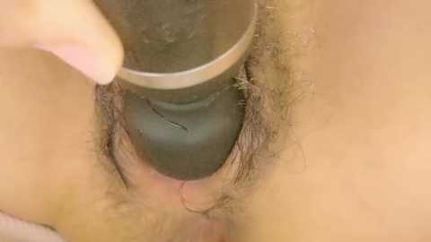 A close-up video of a person's vulva being irrigated with a clear, metallic syringe. The pubic hair is trimmed and the skin is light brown. The image is clinical and focused on the medical procedure.