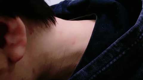 Media: Close-up video of a person's back, showing acne with redness, light skin tone, and a dark blue denim shirt partially pulled up.