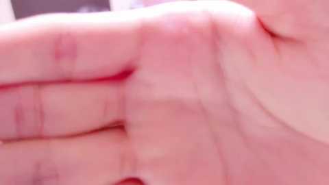 Media: A close-up video of a human hand with light skin tone, visible veins, and slightly rough texture, likely in a medical or clinical setting.