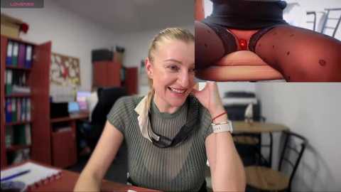 Media: A video of a smiling, blonde, fair-skinned woman in a green ribbed top, seated at a desk in a cluttered office. Close-up inset shows her thigh with a small wound and bruise.