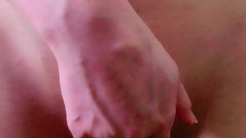 Media: Video of a close-up of a pale, bruised hand with red and purple discoloration, suggesting recent injury. The background is out of focus, highlighting the severity of the bruise.