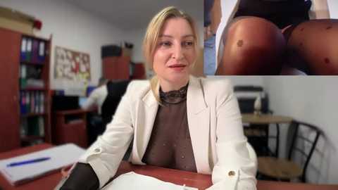 Media: Video of a blonde Caucasian woman in a white blazer over a black top, seated at a desk, with a close-up of a bruised buttock inset. Office background with bookshelves, chairs, and papers.