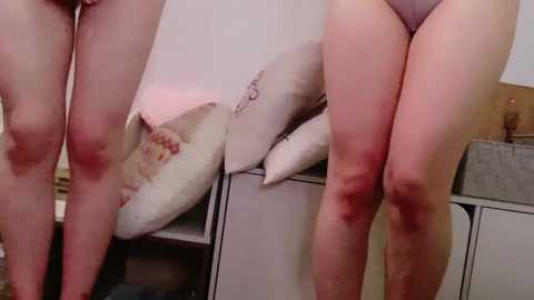 Media: A video juxtaposes two close-up images of a woman's bare legs in different lighting. The left leg has red marks, while the right leg is smooth, highlighting contrast. Background includes a beige cushion and a grey basket.