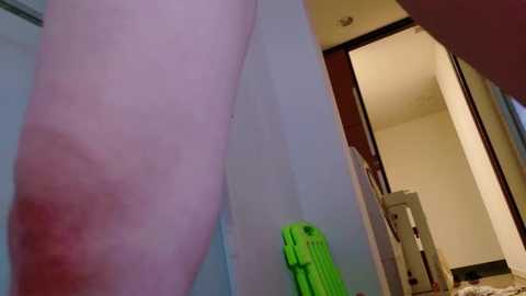 Media: A close-up video of a pale human leg with a prominent red bruise on the inner thigh, taken in a dimly lit bathroom with a green object on the floor and a doorway leading to another room.