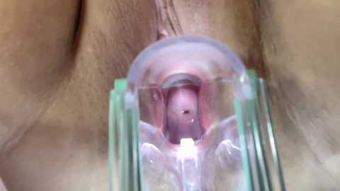 A close-up video showing a clear, cylindrical, transparent device being inserted into a woman's vagina, revealing pink vaginal tissue and labia. The background is blurred, emphasizing the device.