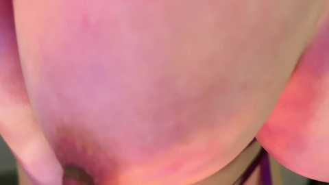 A close-up video of a woman's bare, pale pinkish skin with a large, raised, purple-red rash covering her upper chest and neck. The background is blurred, focusing attention on the rash.