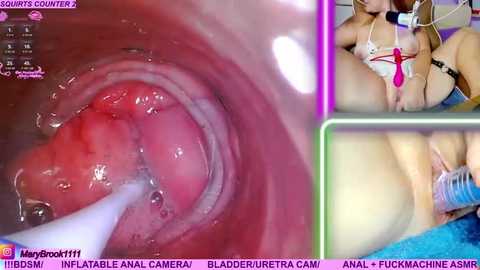 Video of a close-up, explicit vaginal penetration with a dildo, showing the pink, moist interior of the vagina. The image also features a partially visible woman lying on a bed, wearing lingerie.