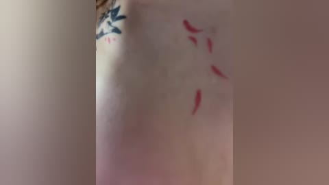 A video of a bare, pale shoulder with a blue floral tattoo and red, claw-like scratches. The background is a plain, light-colored wall.