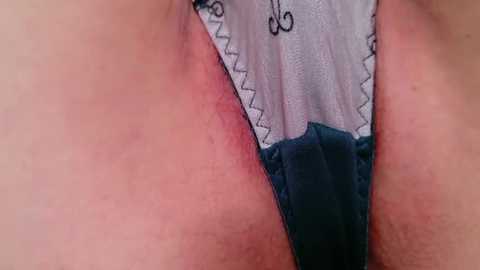 A close-up video of a person's pubic area, showing a slightly red, irritated patch of skin just above a pair of dark blue lace panties with a light gray band.