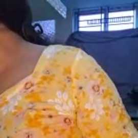 Video of a close-up of a person's shoulder with a yellow, bumpy, possibly infected skin condition. The background features a dimly lit room with barred windows.