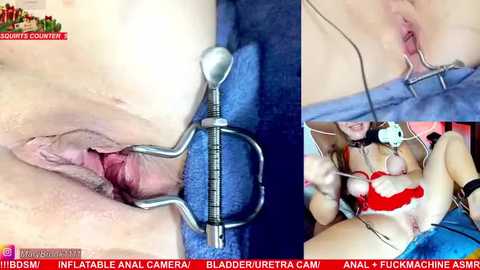 Video depicting a woman's vagina being stretched by a metal device, with close-up shots showing detailed genital anatomy and skin texture.