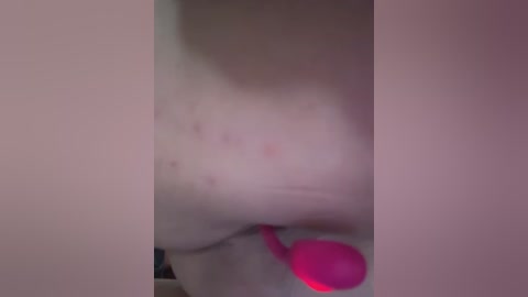 Video of a nude woman with pale skin and red acne spots, lying on her side, with a pink vibrator visible in the lower right corner.