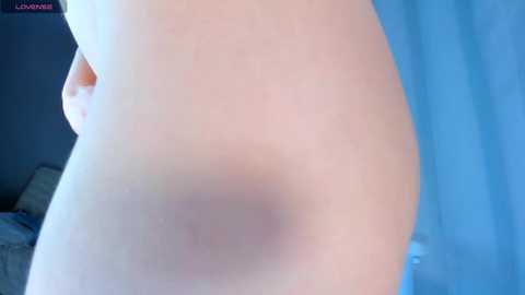A close-up video of a fair-skinned buttock with a noticeable bruise, set against a blue curtain background, featuring a watermark \"LOVEHABIT\" in the top left corner.