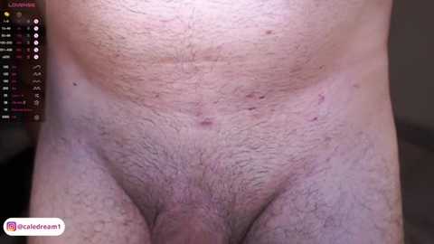 Video of a close-up view of a man's bare lower torso, showing a hairy, slightly reddened, and slightly swollen genital area. Background is blurred, with a \"Live Dreamer\" watermark visible.