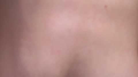 Video of a close-up of a person's bare skin, showing a red, inflamed area with small bumps and a slightly raised texture, possibly an allergic reaction or rash. The background is blurred and out of focus.