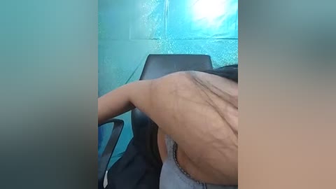 A video of a person with a large, swollen arm, possibly from a blood clot, sitting in a chair against a turquoise wall.