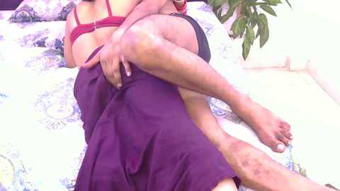 A video of a woman in a maroon bra, lying on a bed with a patterned white and blue sheet, legs crossed, showing her dark brown skin and a bruised leg.