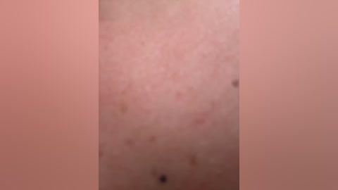Video of a close-up of a light-skinned arm with a reddish-brown mole near the elbow. The skin appears smooth with slight texture variations. The background is a solid, light pink color, creating a uniform backdrop.