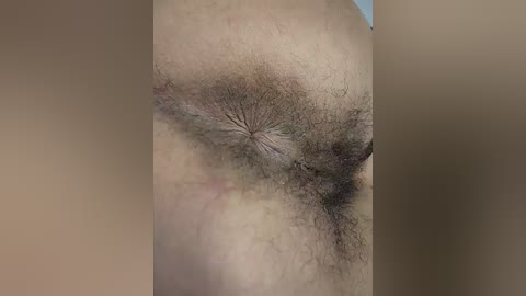 Media: A close-up video of a woman's genital area, featuring pubic hair, labia, and a slight discoloration of the skin. The background is blurred, focusing attention on the intimate details.