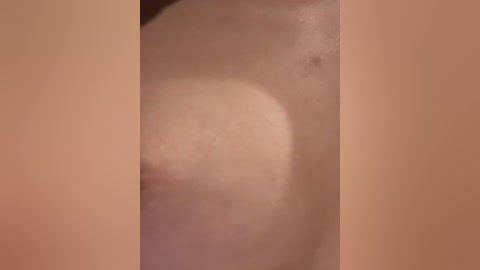 Media: Video of a close-up, circular, light brown mole on a person's skin, surrounded by a tan-colored background. The mole appears smooth and slightly raised.